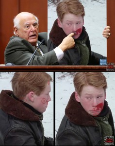 Farkus injuries and expert double